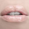 Lips - フォトアルバム - 