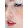 freckles - My photos - 